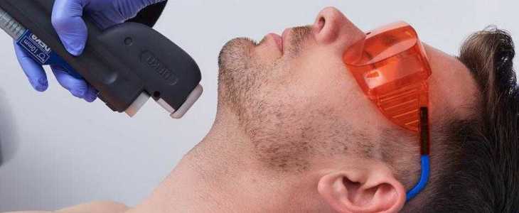 Лазерная эпиляция для мужчин: гладкая кожа без боли и раздражения