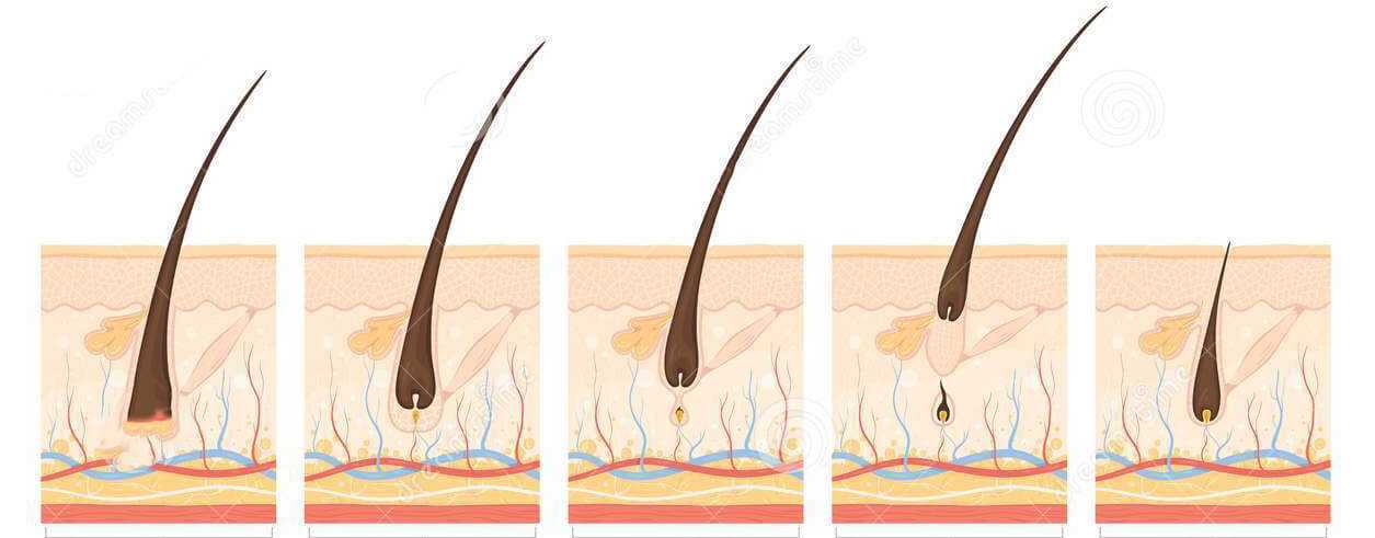 Стадии выпадения волос