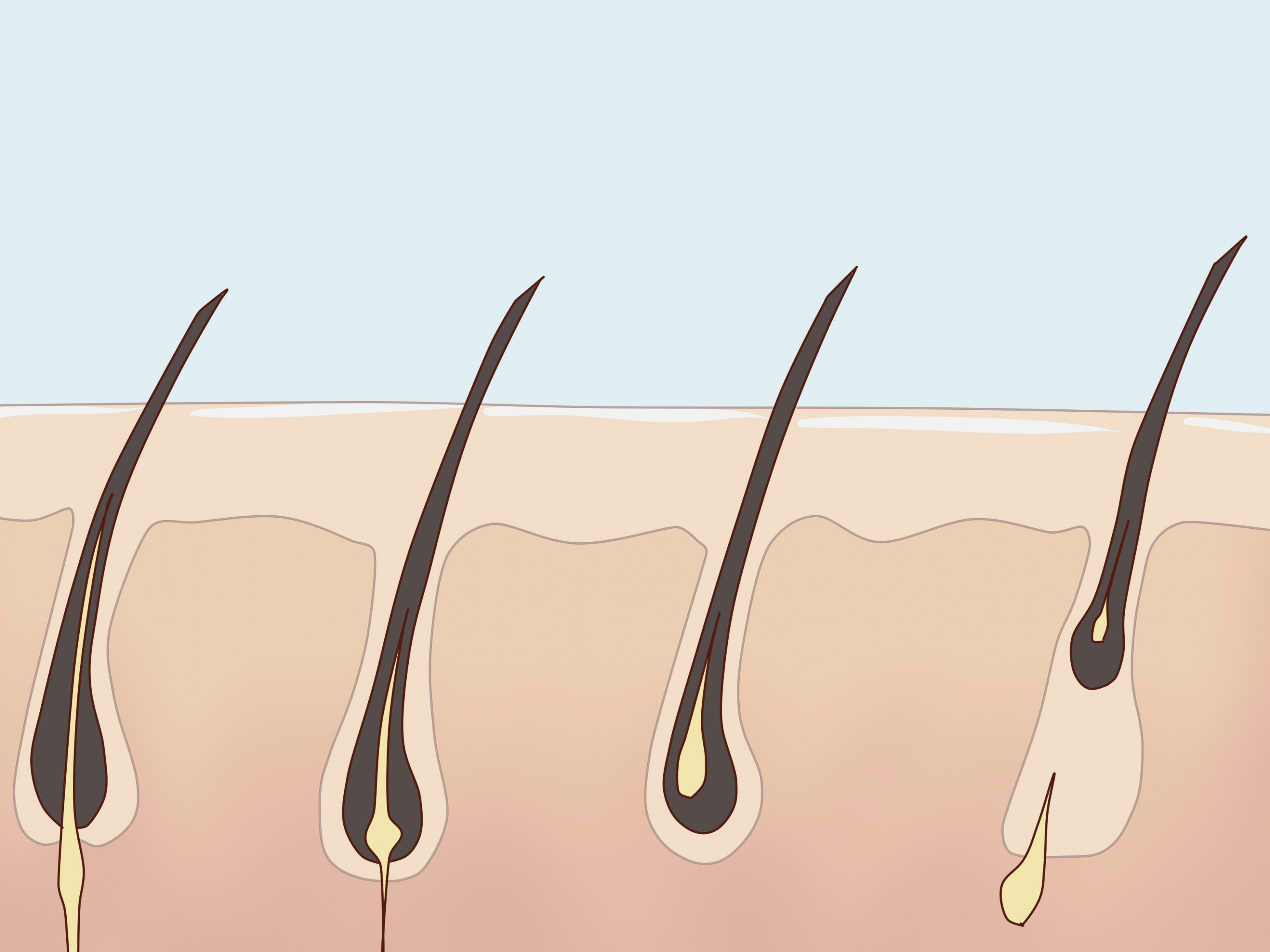 Волосы после шугаринга: сколько не растут и через сколько процедур перестают расти
